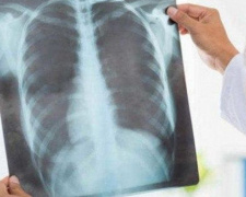 В Украине случаи заболевания пневмонией выросли в два раза