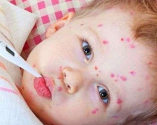 В Украине от кори умер 5-летний мальчик. Донецкая область обеспечена прививками