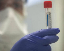 В Мариуполе под наблюдением медиков находятся 242 лица контактировавших с больными коронавирусом