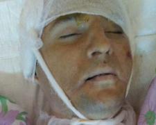В Мариуполе от падения с высоты погиб мужчина: его личность не установлена (ФОТО)