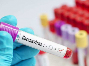 Коронавирус не отступает: в Украине за сутки обнаружено более 15 тысяч новых случаев