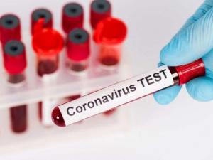 На Донетчине 8 новых пациентов с коронавирусом: среди заболевших ребёнок