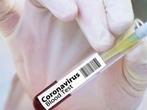 На Донетчине выявили свыше 350 случаев коронавируса: 13 человек умерли