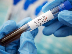 На Донетчине за сутки коронавирус  обнаружили у более 200 жителей