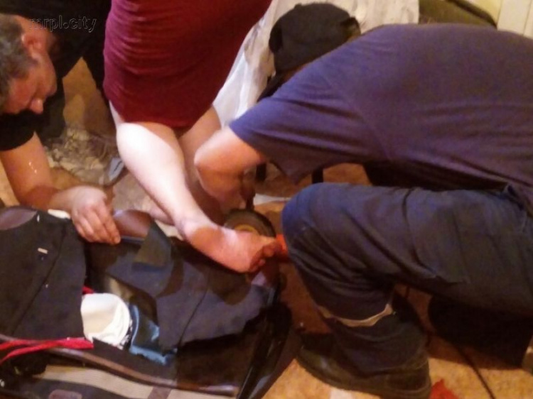 В Мариуполе женщину освобождали от арматуры в ноге болгаркой (ФОТО)