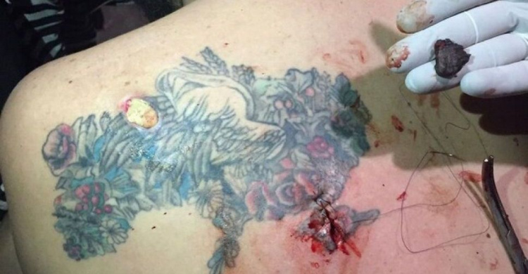 Осколок прошел сквозь вытатуированный на плече Крым: защитник из Мариуполя поделился щемящей фотографией