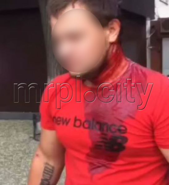 Едва стоял на ногах с окровавленной головой: в Мариуполе мужчину избили битой на улице