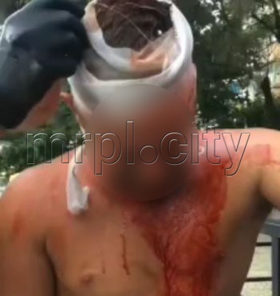 Едва стоял на ногах с окровавленной головой: в Мариуполе мужчину избили битой на улице