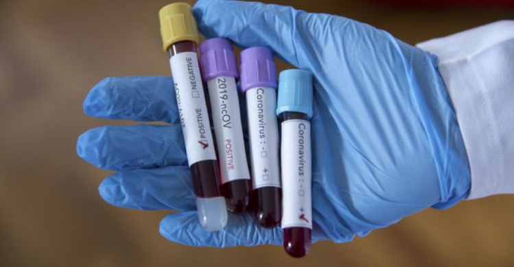 На Донетчине за сутки выявили полтысячи новых больных коронавирусом