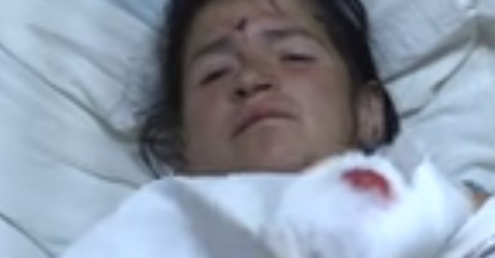 Появилось видео с места обстрела остановки в Авдеевке и интервью с пострадавшей женщиной (ВИДЕО)