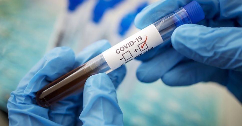Невидимый враг: эксперты Минздрава Украины отвечают на часто задаваемые вопросы о коронавирусе