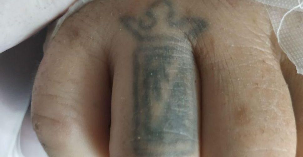 Мариупольцев просят помочь установить личность умершего (ФОТО 18+)