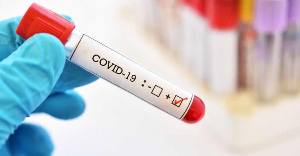 Последние данные по COVID-19 в Донецкой области и в Украине