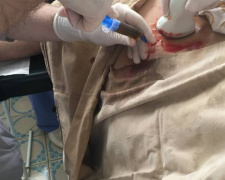 Мариупольские хирурги и гинекологи провели уникальную операцию беременной (ФОТО)