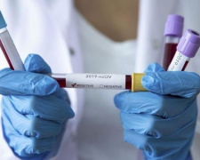 В Украине сделано более 17 миллионов прививок от COVID-19. Зафиксирован «антирекорд» по заболевшим за сутки