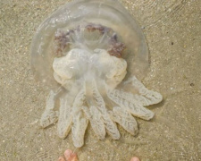 Медуза обожгла четырехлетнего ребенка на мариупольском пляже