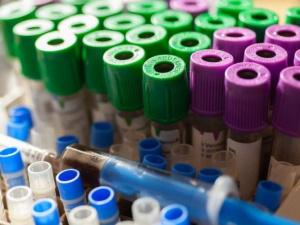 В Украине планируют запустить массовое ИФА-тестирование на антитела COVID-19