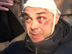 Провокатор или невинная жертва? В Мариуполе таксист побил пассажира (ФОТО+ВИДЕО)