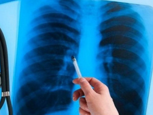 Мариупольцы могут за пять минут провериться на туберкулез в режиме онлайн