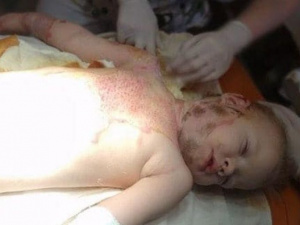 Девочка из многодетной семьи попала в беду. Мариупольцев просят помочь (ФОТО)