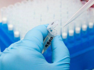 Мариупольцы могут бесплатно пройти тест на вирусы гепатита В и С (ФОТО)