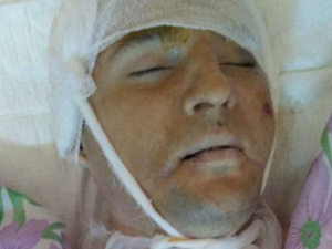В Мариуполе от падения с высоты погиб мужчина: его личность не установлена (ФОТО)