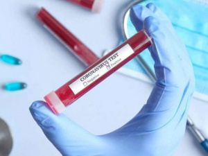 В Украине за сутки более 900 новых случаев коронавируса