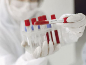 В Мариуполе в референс лабораторию отправлено 69 проб на выявление коронавируса