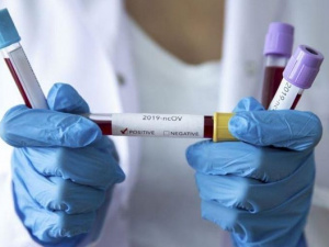 В Украине сделано более 17 миллионов прививок от COVID-19. Зафиксирован «антирекорд» по заболевшим за сутки