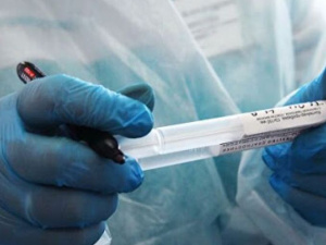 В Украине за сутки 648 случаев коронавируса. Девять пациентов умерли