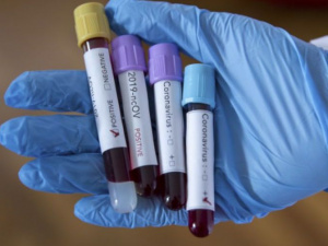 На Донетчине за сутки выявили полтысячи новых больных коронавирусом