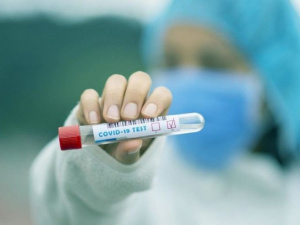 В Украине за сутки коронавирус выявили у 3130 человек