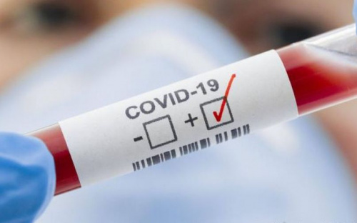 В Украине вдвое увеличилось количество заболевших COVID-19 за сутки