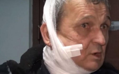 В ОБСЕ сообщили, с какой стороны обстрелян автобус с жертвами в Еленовке 