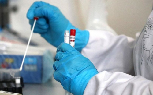 В Украине за сутки число заболевших COVID-19 превысило число выздоровевших