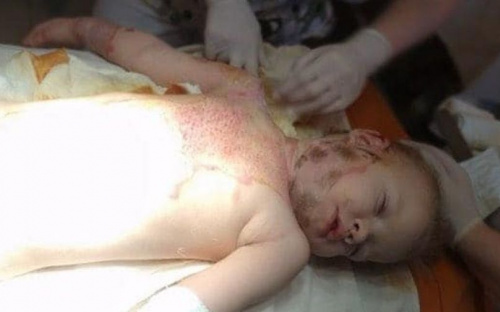 Девочка из многодетной семьи попала в беду. Мариупольцев просят помочь (ФОТО)