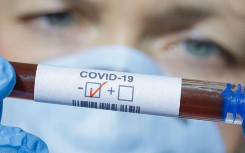 В Украине от COVID-19 умерли еще 33 пациента: трое из них – на Донетчине