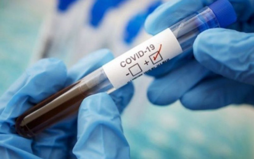 Смертельный рекорд: 49 украинцев умерли от COVID-19 за сутки