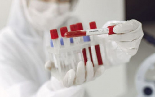 В Мариуполе в референс лабораторию на выявление коронавируса отправлено 236 проб