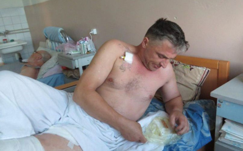 Укус крупного насекомого: госпитализация мариупольца с опасностью ампутации ноги (ФОТО)
