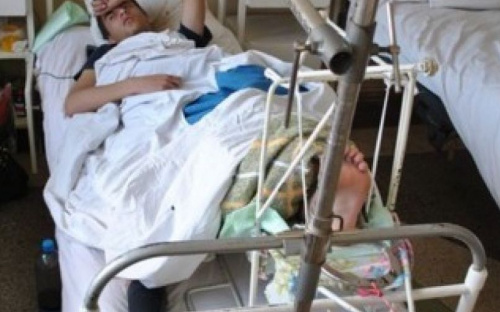 В Мариуполе 11 человек с переломами и ушибами попали в больницы