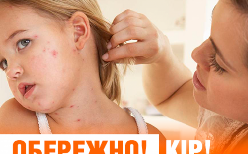 Мариуполь «помог» Украине стать лидером по заболеваемости корью в Европе