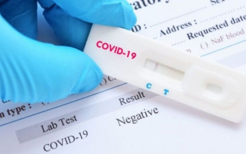 За сутки в Украине зафиксировано более тысячи новых случаев COVID-19