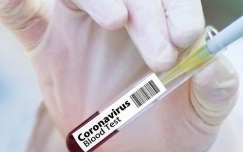На Донетчине выявили свыше 350 случаев коронавируса: 13 человек умерли