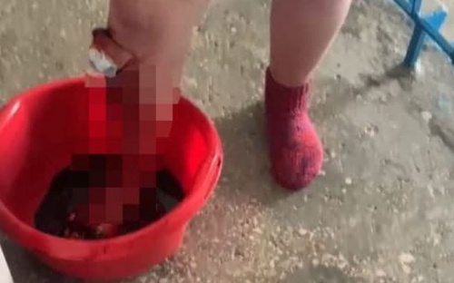 Жительнице Мариуполя с открытой раной помогли полицейские
