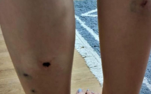 В Мариуполе уличные собаки напали на подростка. Жители просят не увозить животных со двора