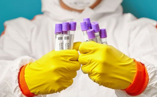 В Украине зафиксировано 16,4 тысяч случаев COVID-19: более 400 пациентов умерли