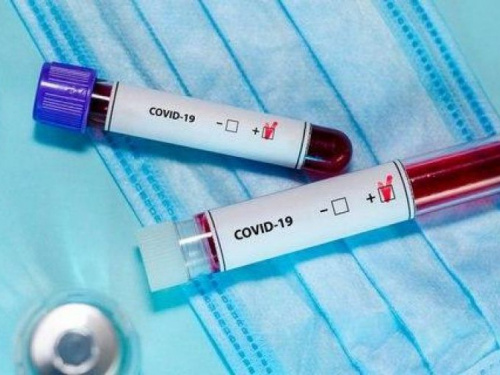 В Украине зафиксировано 897 подтверждённых случаев COVID-19