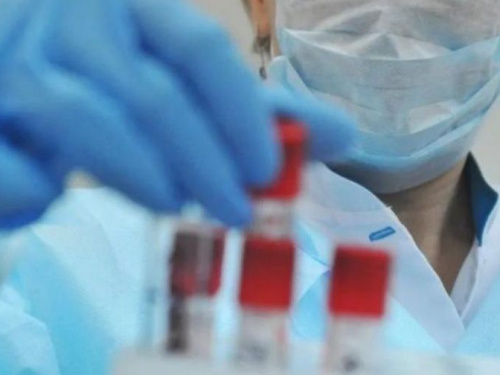 В Украине – более 2 тысяч новых случаев COVID-19