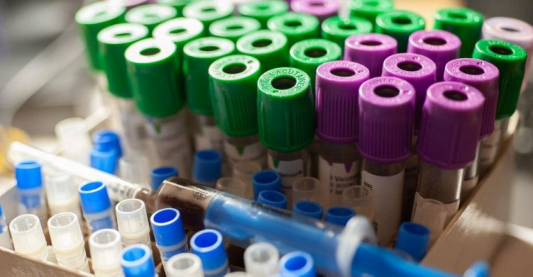 В Украине планируют запустить массовое ИФА-тестирование на антитела COVID-19